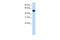 ZFP82 Zinc Finger Protein antibody, 29-131, ProSci, Western Blot image 