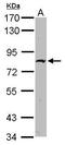 Zinc Finger Protein 326 antibody, GTX118581, GeneTex, Western Blot image 