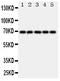 Nuclear Factor, Erythroid 2 Like 2 antibody, PA1828, Boster Biological Technology, Western Blot image 