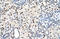 Proteasome Activator Subunit 3 antibody, orb330469, Biorbyt, Immunohistochemistry paraffin image 
