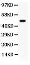 Serum/Glucocorticoid Regulated Kinase 1 antibody, PA5-79992, Invitrogen Antibodies, Western Blot image 