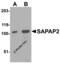 DLGAP2 antibody, 4625, ProSci, Western Blot image 