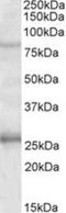 GPRIN Family Member 3 antibody, NBP2-27570, Novus Biologicals, Western Blot image 