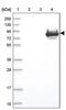 Solute Carrier Family 12 Member 4 antibody, PA5-59444, Invitrogen Antibodies, Western Blot image 