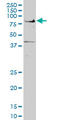 Transcription Factor 7 Like 2 antibody, LS-C105037, Lifespan Biosciences, Western Blot image 