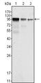 FER Tyrosine Kinase antibody, GTX83329, GeneTex, Western Blot image 