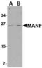 Mesencephalic Astrocyte Derived Neurotrophic Factor antibody, TA306478, Origene, Western Blot image 