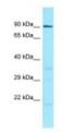 Interphotoreceptor Matrix Proteoglycan 1 antibody, NBP1-98597, Novus Biologicals, Western Blot image 