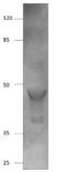 Alpha-Methylacyl-CoA Racemase antibody, GTX15893, GeneTex, Western Blot image 