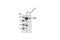 CF Transmembrane Conductance Regulator antibody, 2269S, Cell Signaling Technology, Western Blot image 