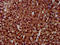 Lysosomal Protein Transmembrane 4 Alpha antibody, LS-C671738, Lifespan Biosciences, Immunohistochemistry paraffin image 