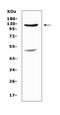 Mucin 1, Cell Surface Associated antibody, A00187, Boster Biological Technology, Western Blot image 