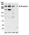 Senataxin antibody, A301-104A, Bethyl Labs, Western Blot image 