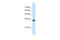 Solute Carrier Family 25 Member 38 antibody, ARP43978_P050, Aviva Systems Biology, Western Blot image 