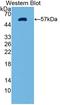 Protein Tyrosine Kinase 2 Beta antibody, LS-C374106, Lifespan Biosciences, Western Blot image 