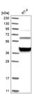 ADAMTS Like 2 antibody, HPA031082, Atlas Antibodies, Western Blot image 