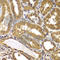 Presenilin 2 antibody, A7719, ABclonal Technology, Immunohistochemistry paraffin image 