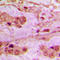 Apoptosis inhibitor 5 antibody, LS-C353072, Lifespan Biosciences, Immunohistochemistry paraffin image 