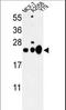 Chromobox 1 antibody, LS-C168361, Lifespan Biosciences, Western Blot image 