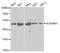 Serpin Family H Member 1 antibody, A2517, ABclonal Technology, Western Blot image 