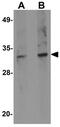 Spindle And Kinetochore Associated Complex Subunit 1 antibody, GTX31390, GeneTex, Western Blot image 