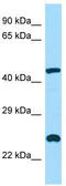 Inositol Polyphosphate-5-Phosphatase A antibody, TA333940, Origene, Western Blot image 