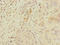 WIP1 antibody, LS-C676294, Lifespan Biosciences, Immunohistochemistry paraffin image 