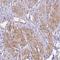 Disco Interacting Protein 2 Homolog A antibody, NBP2-30966, Novus Biologicals, Immunohistochemistry frozen image 