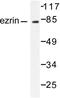 Ezrin antibody, LS-C176014, Lifespan Biosciences, Western Blot image 