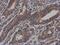 Vezatin, Adherens Junctions Transmembrane Protein antibody, PA5-30651, Invitrogen Antibodies, Immunohistochemistry frozen image 