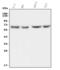 Hyaluronidase 1 antibody, A04099-1, Boster Biological Technology, Western Blot image 