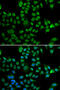 Lamin B2 antibody, 22-257, ProSci, Immunofluorescence image 