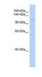 SIN3 Transcription Regulator Family Member B antibody, NBP1-79381, Novus Biologicals, Western Blot image 
