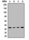 BCL2 Interacting Protein 3 Like antibody, LS-C668490, Lifespan Biosciences, Western Blot image 