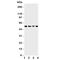TNF Receptor Associated Factor 4 antibody, R31116, NSJ Bioreagents, Western Blot image 
