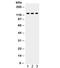 Toll Like Receptor 7 antibody, R32339, NSJ Bioreagents, Western Blot image 