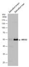 Meis Homeobox 2 antibody, NBP2-17263, Novus Biologicals, Western Blot image 