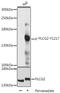 Phospholipase C Gamma 2 antibody, LS-C750610, Lifespan Biosciences, Western Blot image 