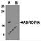 Energy Homeostasis Associated antibody, 7527, ProSci, Western Blot image 