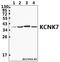 Potassium Two Pore Domain Channel Subfamily K Member 7 antibody, A15165-1, Boster Biological Technology, Western Blot image 