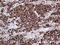 CD79b Molecule antibody, LS-C800093, Lifespan Biosciences, Immunohistochemistry paraffin image 