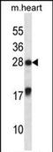 MAX Interactor 1, Dimerization Protein antibody, PA5-71929, Invitrogen Antibodies, Western Blot image 