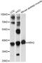 Histamine Receptor H2 antibody, LS-C749184, Lifespan Biosciences, Western Blot image 