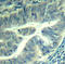 Cyclin Dependent Kinase 6 antibody, LS-C335940, Lifespan Biosciences, Immunohistochemistry frozen image 
