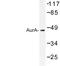 Aurora Kinase A antibody, LS-C176675, Lifespan Biosciences, Western Blot image 