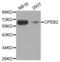 Cytoplasmic Polyadenylation Element Binding Protein 2 antibody, abx004621, Abbexa, Western Blot image 