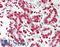 Zinc Finger Protein 335 antibody, LS-B13989, Lifespan Biosciences, Immunohistochemistry paraffin image 
