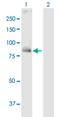 Protein-glutamine gamma-glutamyltransferase K antibody, H00007051-B02P, Novus Biologicals, Western Blot image 