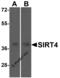 Sirtuin 4 antibody, 5769, ProSci, Western Blot image 