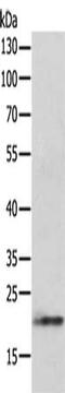 p21 antibody, CSB-PA297162, Cusabio, Western Blot image 